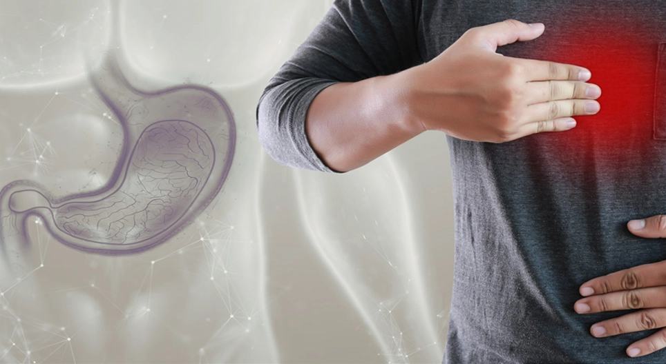 Achalasia and gastroesophageal reflux disease (GERD)