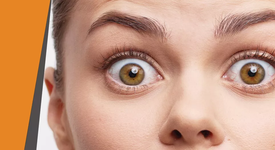 Traut euren Augen nicht