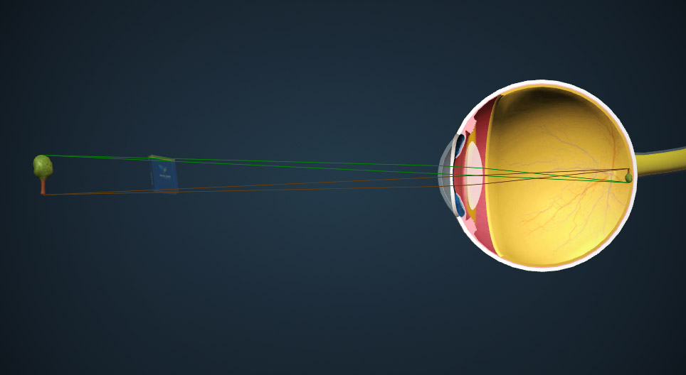 Die Bilderzeugung im Auge