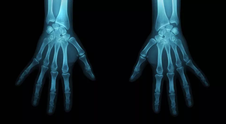 Γίνε ιατροδικαστικός ανθρωπολόγος