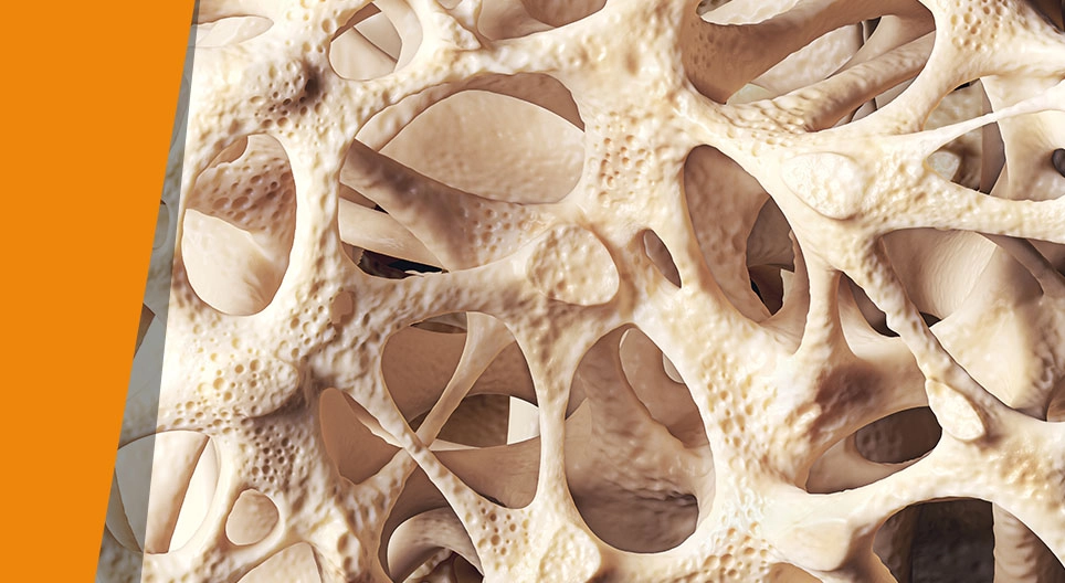 Αδύναμα οστά