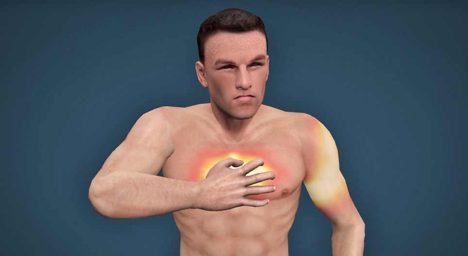 What you need to know about heart attacks