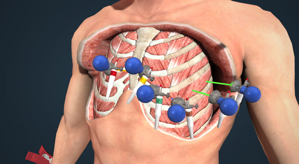 The electrocardiogram (ECG)