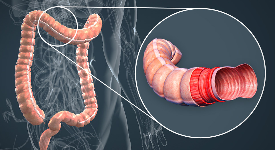 La anatomía del intestino grueso