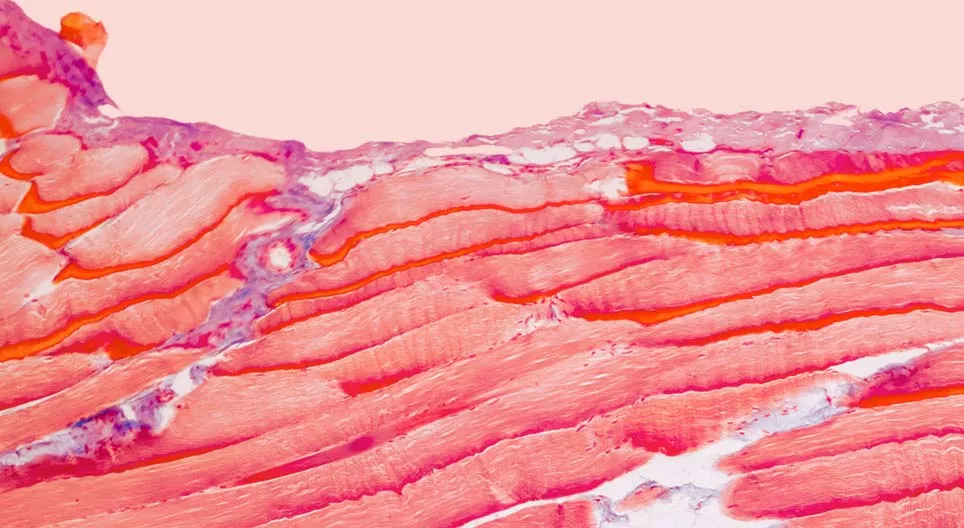 Quels sont les tissus qui constituent nos muscles ?