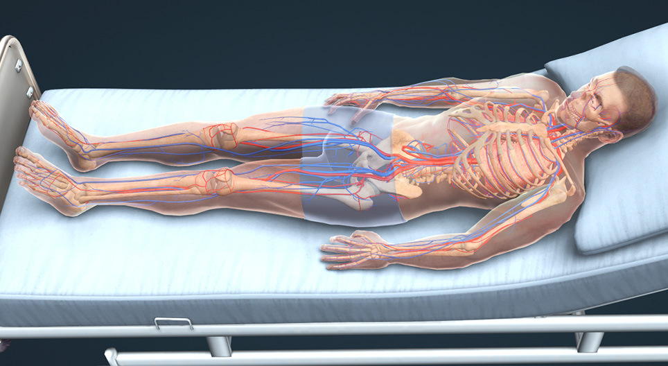 La thrombose veineuse profonde et l'embolie pulmonaire