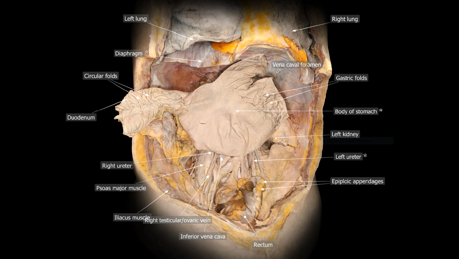 Mozaik Education and the University of Szeged have developed a digital anatomy platform