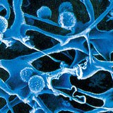 Fibers and white blood cells inside the lymph node