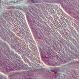 Ínszövet (keresztmetszet)