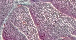 Ínszövet (keresztmetszet)