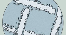 Géz mikroszkópos képe