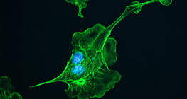 Sejtváz (szarvasmarha tüdejében található sejtekben)