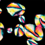 Keményítőszemcsék burgonyagumóból készített kaparékban (polarizációs felvétel)