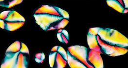 Keményítőszemcsék burgonyagumóból készített kaparékban (polarizációs felvétel)