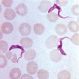 Spiral-shaped bacteria of syphilis