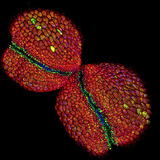 Mirabilis flower pollen sac (confocal laser scanning microscope)