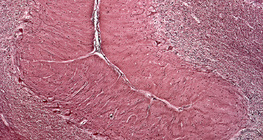 Kisagyból készült metszet (ember)