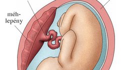 A magzat elhelyezkedése az anyaméhben 