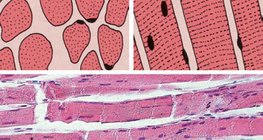 Harántcsíkolt izomszövet