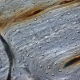 Bone (longitudinal section)