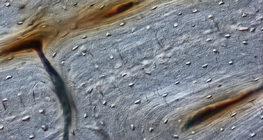 Csont (hosszanti csiszolat)