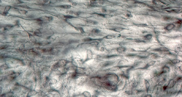 Laza rostos kötőszövet