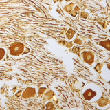 Idegsejtek a gerincvelői dúcban