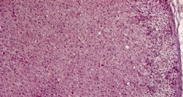 Mellékveséből készült keresztmetszet