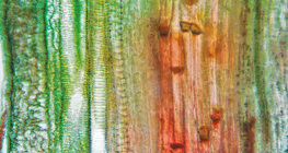 Növényi szállítószövet hosszanti metszete (tök szárából)