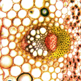 Vascular bundles, cross section (dicot)