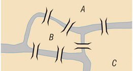 A königsbergi hidak