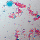A TBC kórokozója (Mycobacterium tuberculosis)