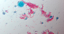 A TBC kórokozója (Mycobacterium tuberculosis)