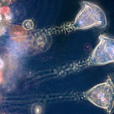 Vorticella (freshwater protozoa)