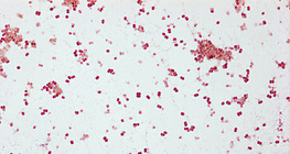 A gonorrhoea kórokozója (Neisseria gonorrhoeae)