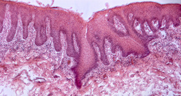 Nyelvből készült keresztmetszet (ember)
