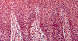 Nyelvből készült keresztmetszet (ember)