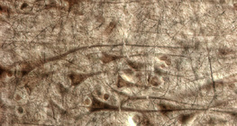 Emberi agykéreg; a nagy mozgató piramissejtek rétege látszik