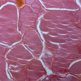 Section of thyroid gland