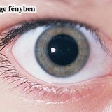 A pupilla gyenge fényben