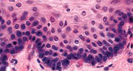 Többrétegű, el nem szarusodó hám