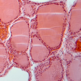 Section of thyroid gland