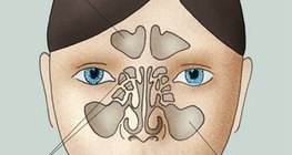 Az orrmelléküregek