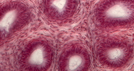 Herecsatornák keresztmetszete