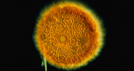 Szivacs gemmula, gyöngysarj (Tavi szivacs, Spongilla lacustris)