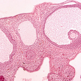 Transverse section of ovary (mammal)