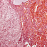 Hipofízis (hosszanti metszet, kis nagyítású kép)