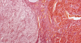 Hipofízis (hosszanti metszet, kis nagyítású kép)