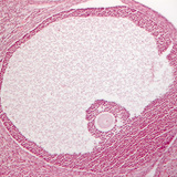 Transverse section of ovary (mammal)