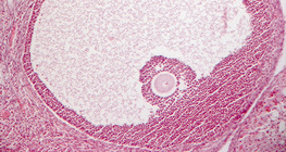 Petefészekből készült keresztmetszet (emlős)